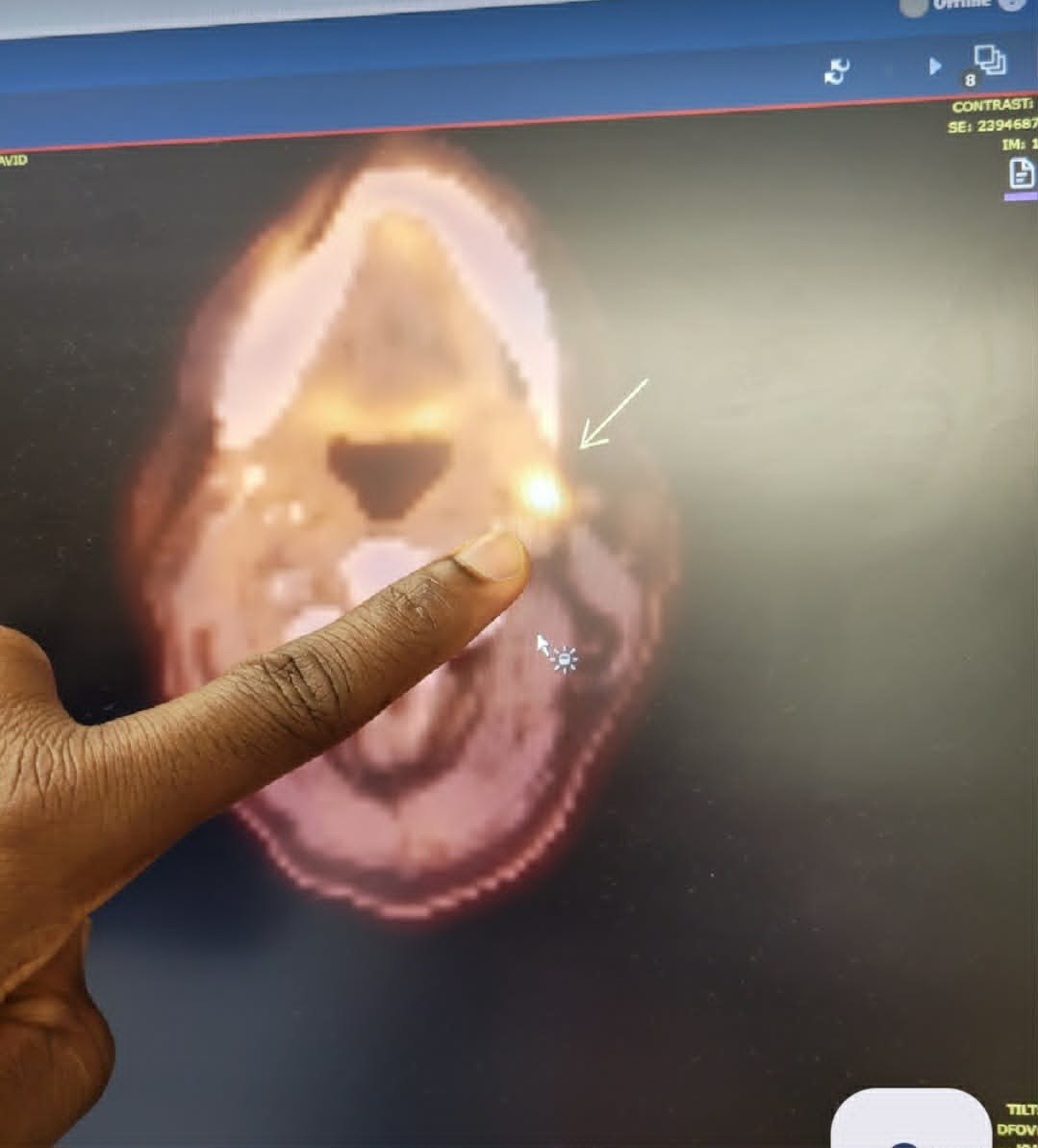A medical scan from David's cancer journey