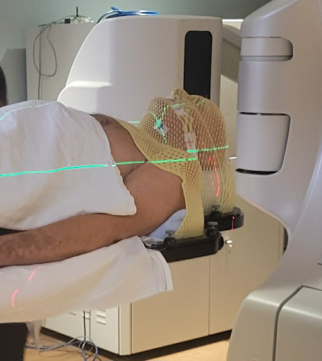 David receiving radiation treatment